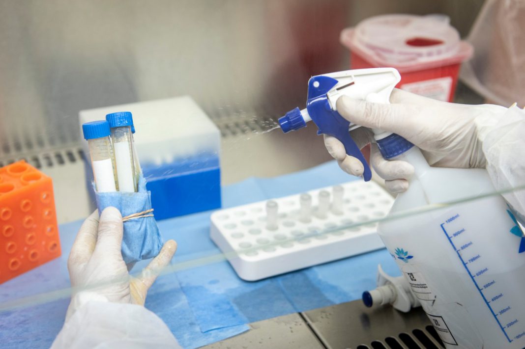 El Instituto Malbrán analiza 300 muestras diarias de casos sospechosos de coronavirus y puede triplicar ese número, ya que no tiene colmada su capacidad operativa, informó el Ministerio de Salud de la Nación - Foto: Telam