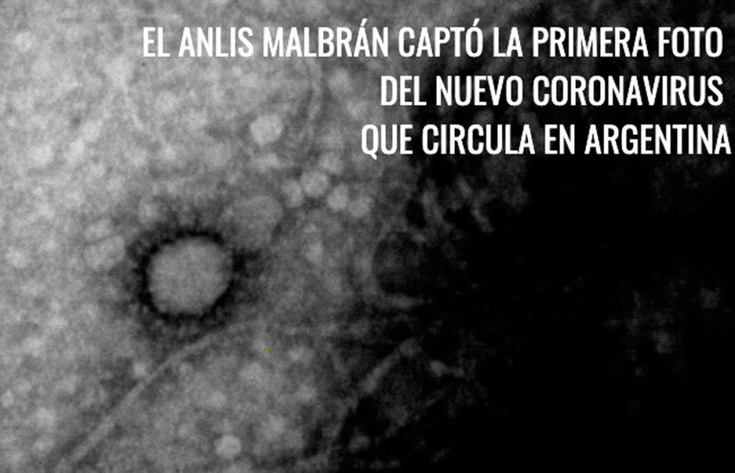 Coronavirus en Argentina - Foto: Telam