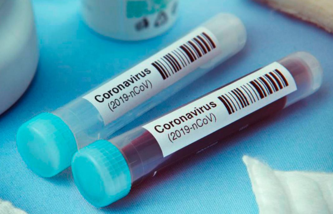 Anuncian en EE.UU las primeras pruebas positivas de una vacuna