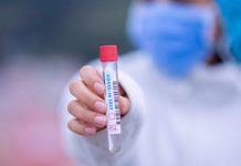 Test Covid-19 - Foto: