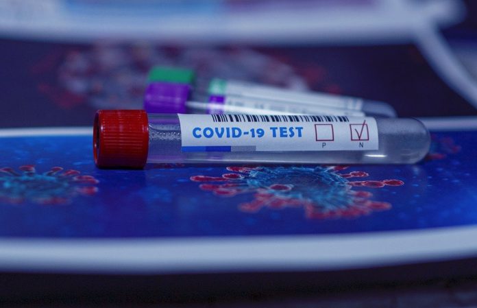 Test Covid-19 - Foto: