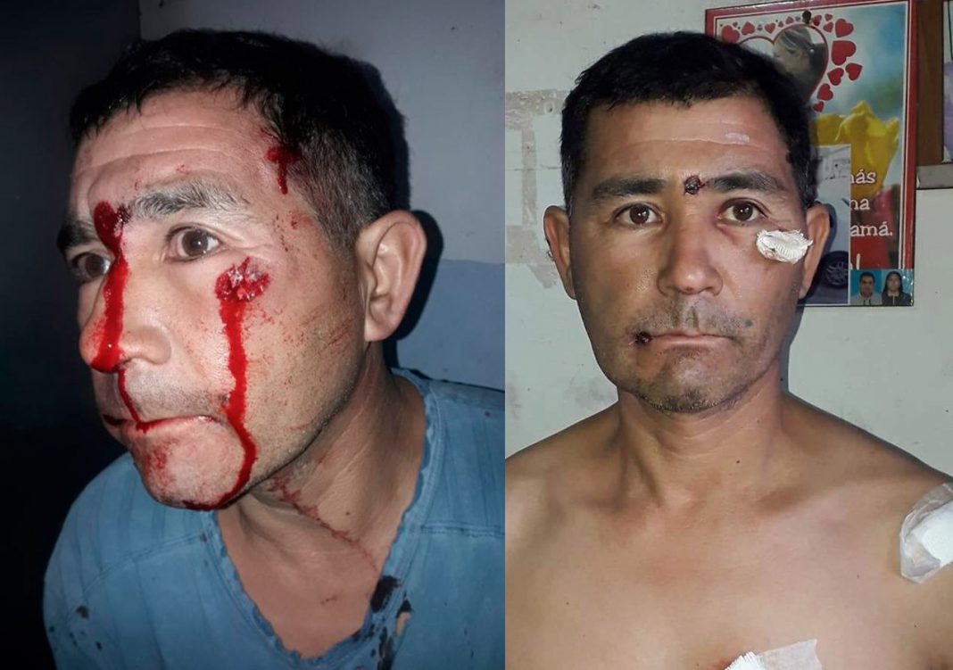 Gabriel Frede sufrió en carne propia la brutalidad policialGabriel Frede sufrió en carne propia la brutalidad policial - Foto:
