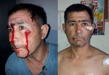 Otra vez, violencia policial en Chubut Gabriel Frede sufrió en carne propia la brutalidad policialGabriel Frede sufrió en carne propia la brutalidad policial - Foto: