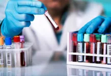 Bioquímicos cobrarán "bono" de compensación a afiliados de prepagas