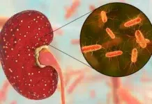 Preocupa el alza de los casos de Síndrome Urémico Hemolítico Síndrome Urémico Hemolítico